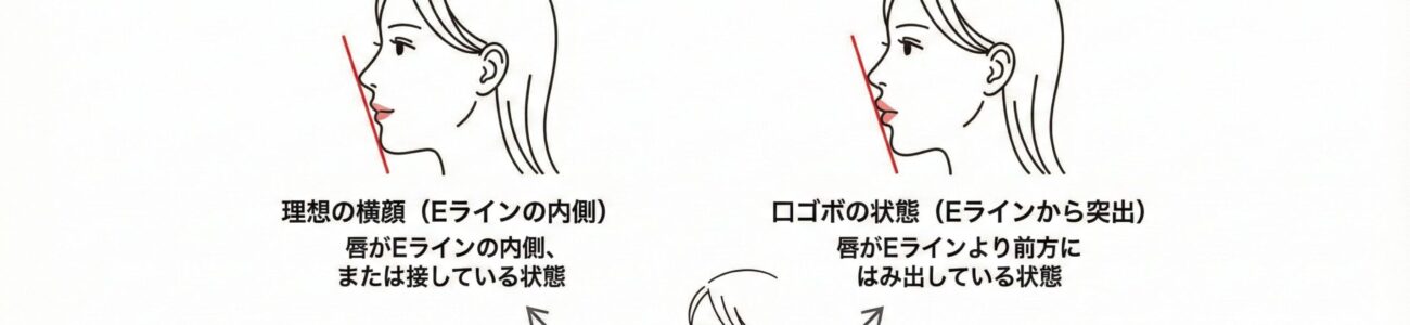 口ゴボ（くちごぼ）とは？3秒セルフチェックと「手術なし」で治す方法を専門医が解説